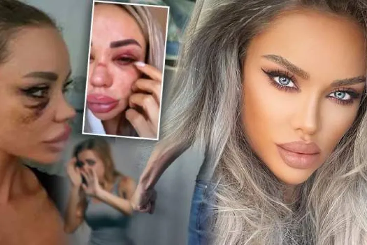 De ce a fost bătută Bianca Drăgușanu. Un fost prezentator TV a dezvăluit amănunte