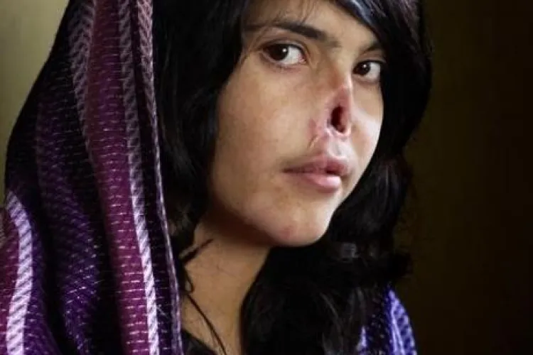 O fotografie socanta a castigat premiul World Press Photo 2010