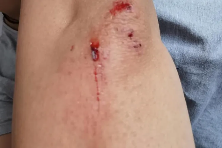 Clujeancă pe bicicletă cu copilul, lovită de un ”livrator”, care verifica hărțile pe mobil în timp ce se deplasa