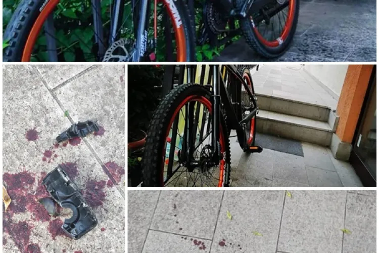 Bicicletă furată din Grigorescu! Hoțul a plătit cu sânge furtul: Va rog share masiv să-l găsesc pe nenorocit - FOTO   