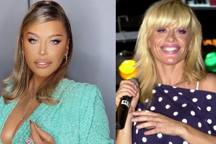 Loredana Groza, criticată din nou din cauza presupuselor operații. Ce replică a dat 