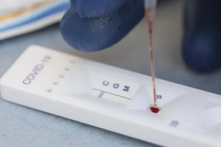 Testele antigen, folosite în raportarea oficială, dau greș în depistarea persoanelor infectate în proporție de 47%