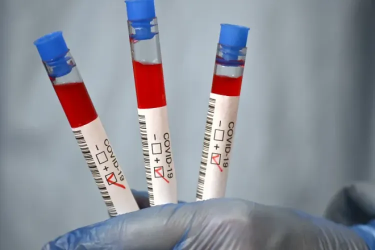 În Cluj sunt tratați 80 de pacienți la Terapie Intensivă. Rata pe județ ajunge miercuri la 9.50