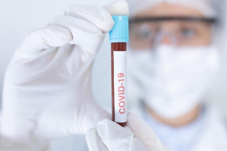 Test PCR care indică tulpina COVID-19 dar și în ce stadiu este boala, creat de cercetătorii români