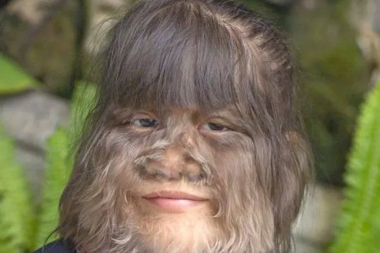 Fetita lup traieste in Thailanda! - VIDEO - Imagini Socante