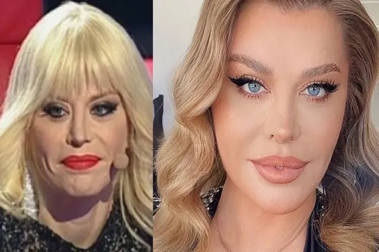 Loredana Groza: ”Nu am liftinguri, nici n-aș avea timp să fac asta!”. Ce spune un medic estetician