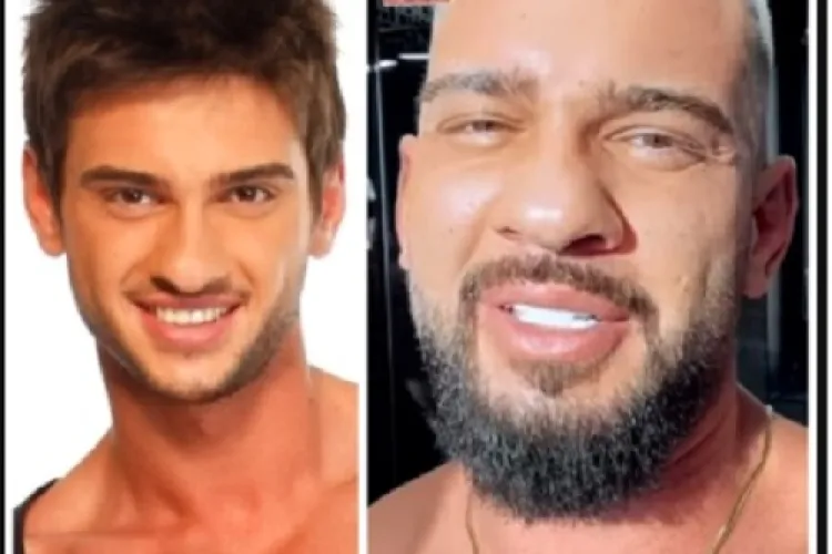 Ce operații estetice are Dorian Popa. Cum s-a schimbat față de acum câțiva ani