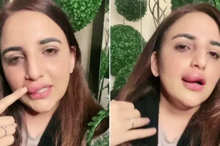 O vedetă TikTok a rămas cu buza umflată! I-au înghețat conturile și nu a mai avut bani de botox -VIDEO