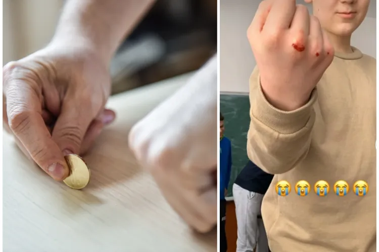 Copii răniți de „moneda rusească”, un joc periculos care face furori printre elevii clujeni. Un consilier local a tras un semnal de alarmă în online