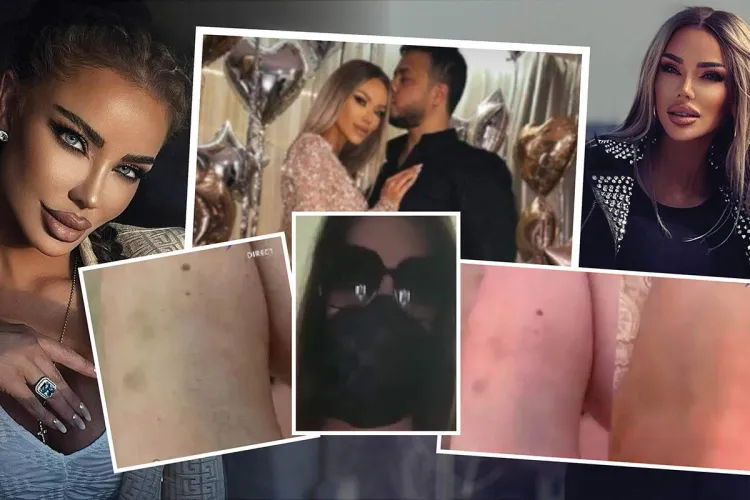 Bianca Drăgușanu, acuzată de hărțuire fizică de o tânără care a fost la o petrecere acasă la Gabi Bădălău: „Mi-a spart capul”