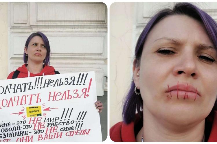 FOTO - O rusoaică și-a cusut gura în semn de protest față de războiul din Ucraina  