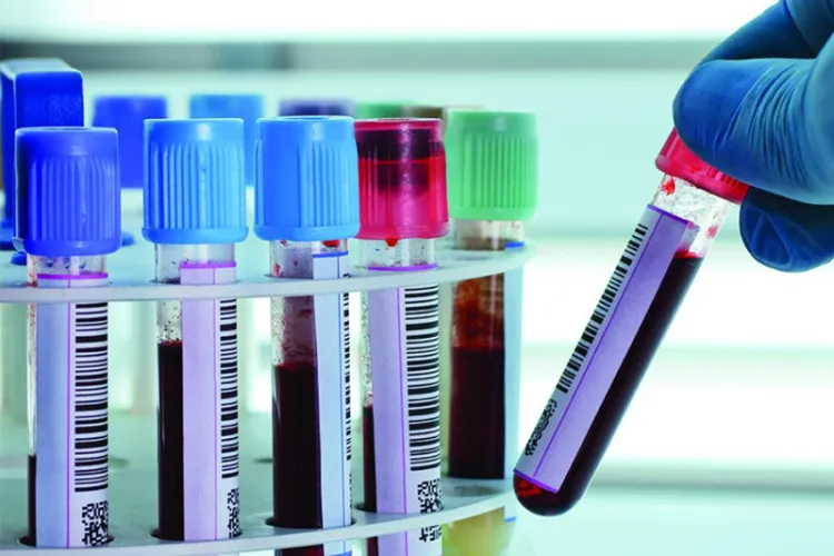 STUDIU: Gripa de sezon poate să fie un posibil descendent direct al gripei spaniole