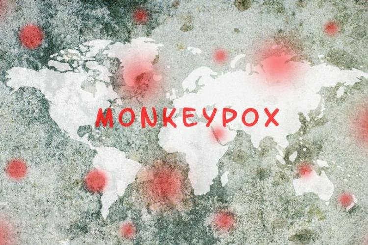 Harta cazurilor de variola maimuţei. În ce ţări a ajuns boala până acum