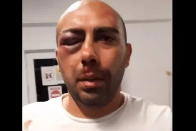 Bărbat rupt în bătaie de poliție. Acesta îi acuză pe agenți că l-au măcelărit - VIDEO   