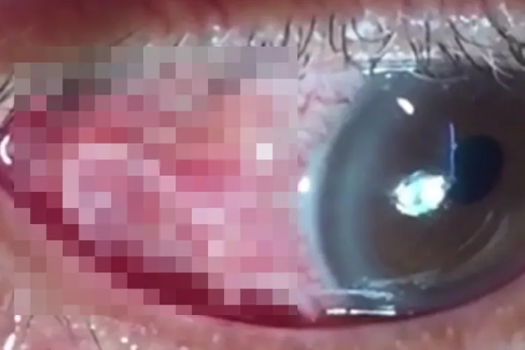 Un cioban a murit la spital în chinuri groaznice! S-a internat la spital cu viermi ieșind din corp. Medicii au fost șocați   