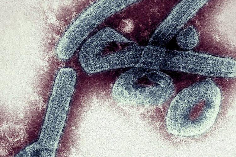 După COVID-19 și variola maimuței, a apărut încă un virus periculos: Au fost confirmate primele cazuri de infectare cu virusul mortal Marburg