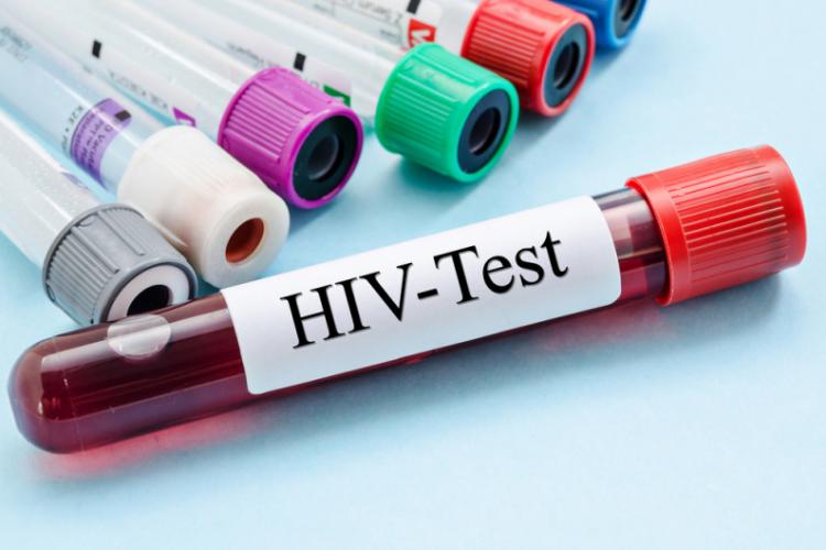 Pas important pentru descoperirea unui tratament SIDA: Al patrulea pacient din lume vindecat de HIV