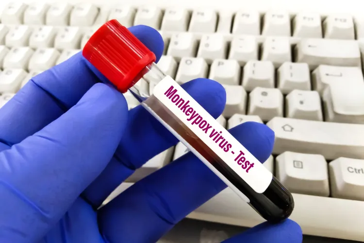 Încă un caz de variola maimuței, depistat la noi în țară. Numărul cazurilor din țara noastră a ajuns la 19