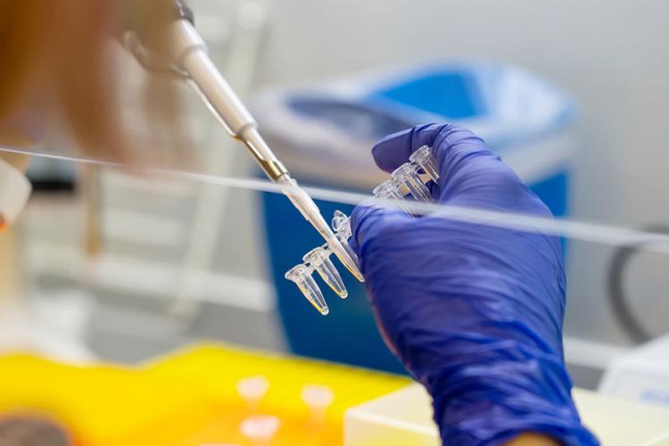 Încă un caz de variola maimuței detectat în România. Bilanțul a ajuns la 21 de persoane infectate