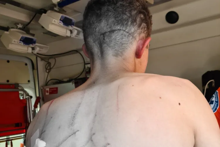 Un tânăr a fost atacat de un urs chiar sub ochii familiei sale. Apropiații băiatului au alungat animalul cu un tractor 