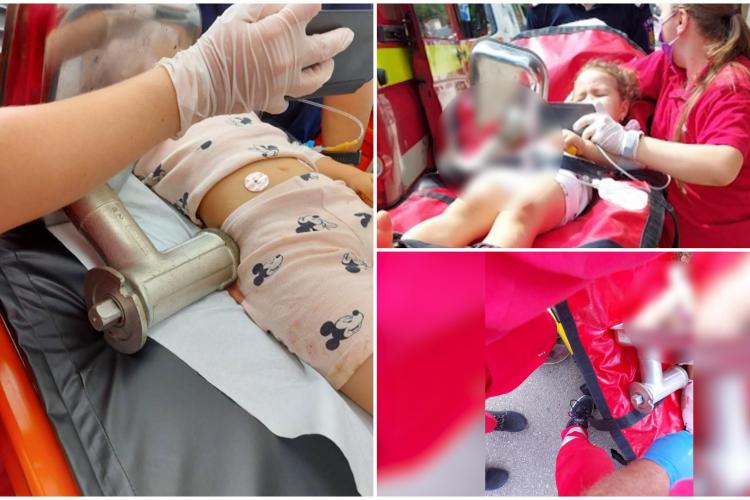 Chirurgii și mecanicii unui spital, ajutați de pompieri, s-au chinuit să dezasambleze o mașină de tocat care i-a prins mâna unei fetiţe de 4 ani