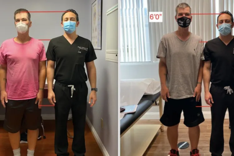 Sute de mii de euro pentru „câțiva centimetri în plus”: Bărbații apelează la o operație chinuitoare în speranța că vor pleca acasă mai înalți 