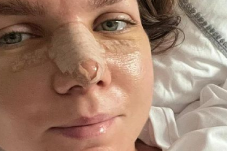 Simona Halep a explicat de ce a ales să facă operația estetică la nas
