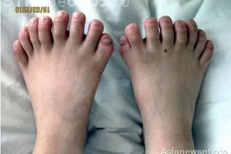 Un copil din China are 31 de degete - Galerie FOTO