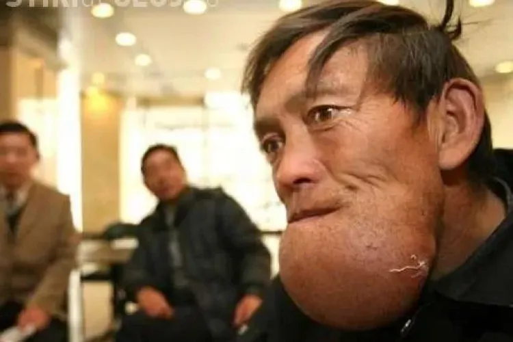 Unui chinez ii "explodeaza" barba - Imagini socante