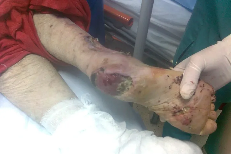 SOCANT! Ministrul Sanatatii face publice fotografii cu pacienti imbolnaviti in spitale - VEZI FOTO