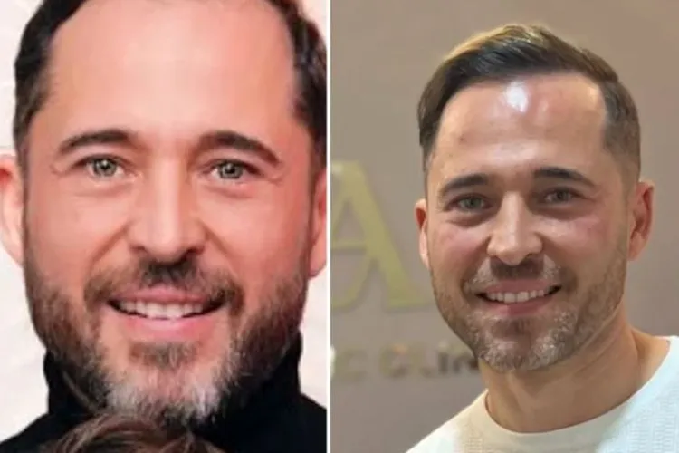 Dinu Maxer face tratamente cosmetice și jignește oamenii muncii: ”Nu trebuie să am frunte de tractorist”