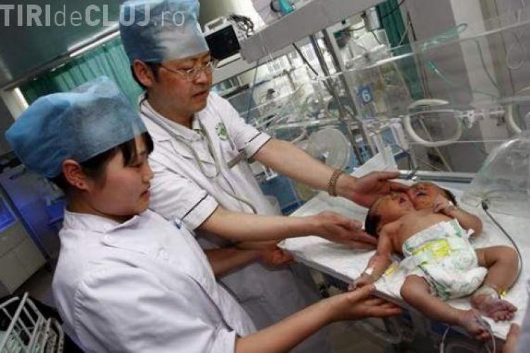 O fetita cu doua capete s-a nascut in China