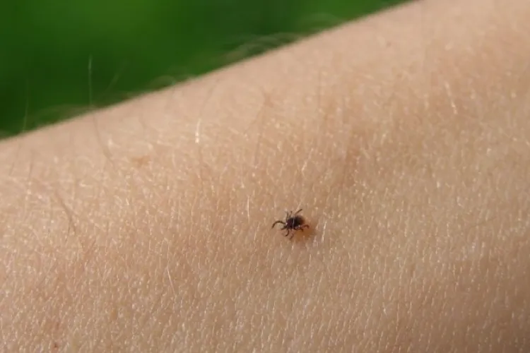 Mușcătura de căpușă, o urgență? Când este periculoasă muşcătura de căpuşă şi cum trebuie să procedezi când păţeşti asta