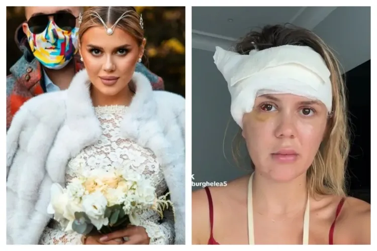 Imagini LIVE cu momentul accidentului în care Emily Burghelea, fosta prezentatoare de la Pro TV, a fost rănită în Mauritius/ Vedeta povestește totul VIDEO 