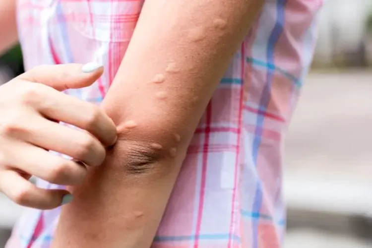 Centrul Clujului, invadat de țânțari! Oamenii sunt disperați: „Nici aparatele anti‐insecte din casă nu îi mai alungă”