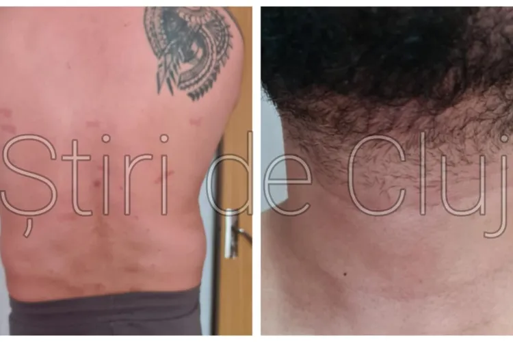 EXCLUSIV: Clujean agresat de polițiști locali că nu a vrut să se legitimeze: „M-au bătut, m-au strâns de gât și înjurat. Nu mai puteam să respir”