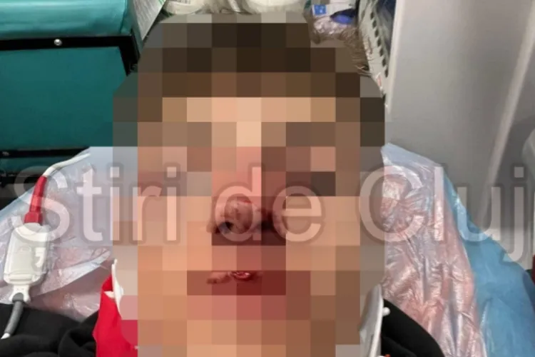 Tânăr suporter al CFR Cluj, desfigurat după ce a fost lovit în față cu o sticlă de rivalii de la ,,U’’ Cluj! A ajuns la spital cu nasul spart  FOTO