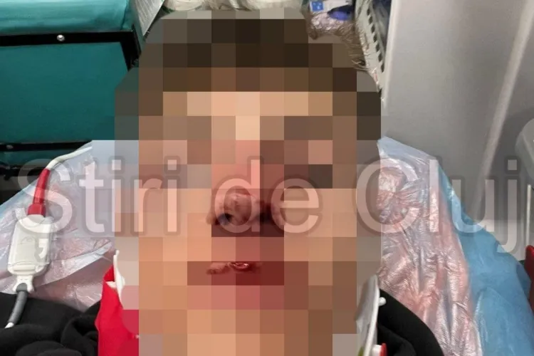 A fost reținut suporterul U Cluj ce a desfigurat un fan CFR Cluj, aruncându-i o sticlă în față. A recunoscut fapta/Poliția: NU A FOST CONFLICT ETNIC! VIDEO