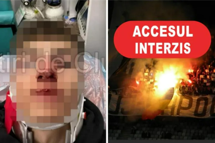 Suporterul U Cluj care a desfigurat un fan CFR Cluj, aruncându-i o sticlă în față, pus sub control judiciar. Are interdicție să se apropie de stadioane 