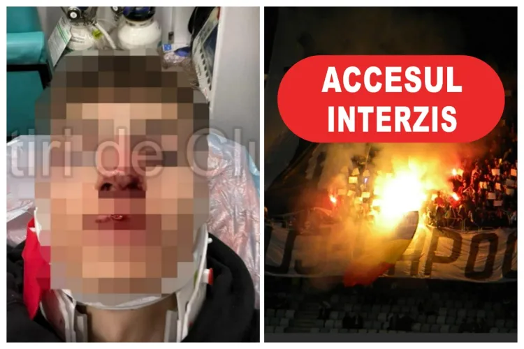 Suporterul U Cluj reținut că a desfigurat un tânăr de 19 ani, fan CFR Cluj, după ce i-a aruncat o sticlă în față, avea INTERDICȚIE 1 an pe stadion