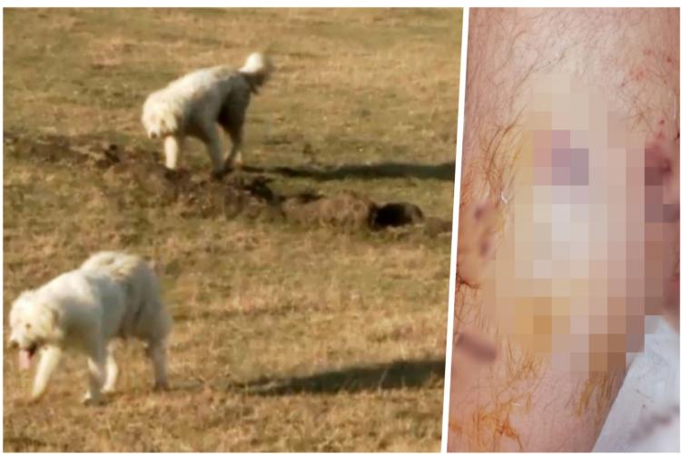 ȘOCANT în Cluj: Un tată din Florești a fost atacat de o haită de câini în timp ce-și proteja fiica de 6 ani pe Dealul Cetății! FOTO