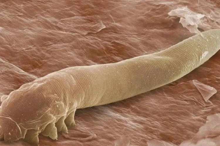 Ce sunt acarienii Demodex, ființele microscopice care trăiesc pe fața noastră. „Îi putem considera prietenii noștri”