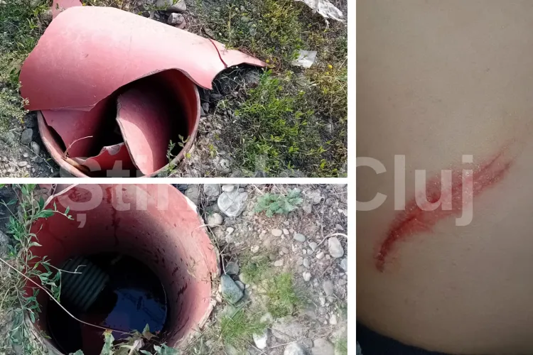 Doi copii din Cluj răniți grav din cauza neglijenței constructorilor: „Nu ne mai putem lăsa copiii afară din case, că se poate întâmpla ceva tragic” FOTO