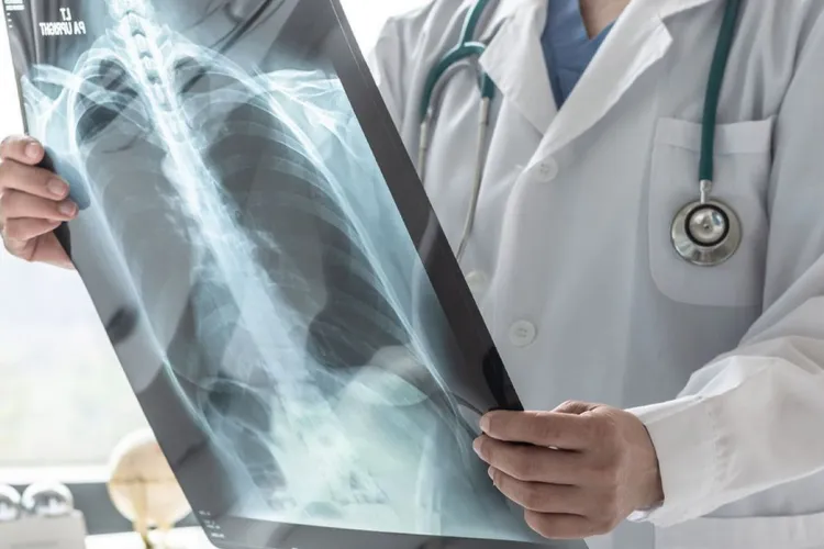 O formă de cancer extrem de rară apare la tot mai mulți tineri. Medicii nu au nicio explicație și sunt îngrijorați