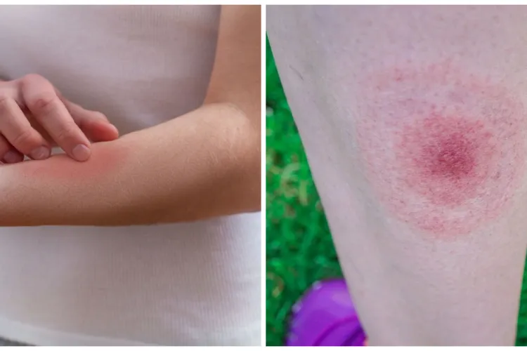 Invazie de insecte dubioase într-un cartier din Cluj-Napoca! Locuitorii, disperați: „Copiii se trezesc cu bube urâte și nu putem ieși din casă!”