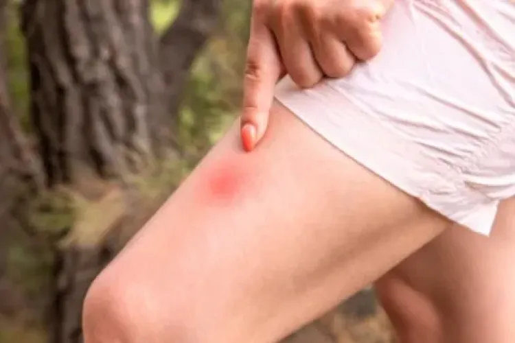  Invazie de musculițe agresive care atacă în roi, în Cluj-Napoca: Înțepături dureroase, copii în pericol și oameni ajunși la Urgențe 