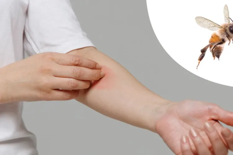 „Atacul viespilor” la Cluj-Napoca! Părinții trag un semnal de alarmă și cer ajutor: „Nu putem intra în curtea blocului” 