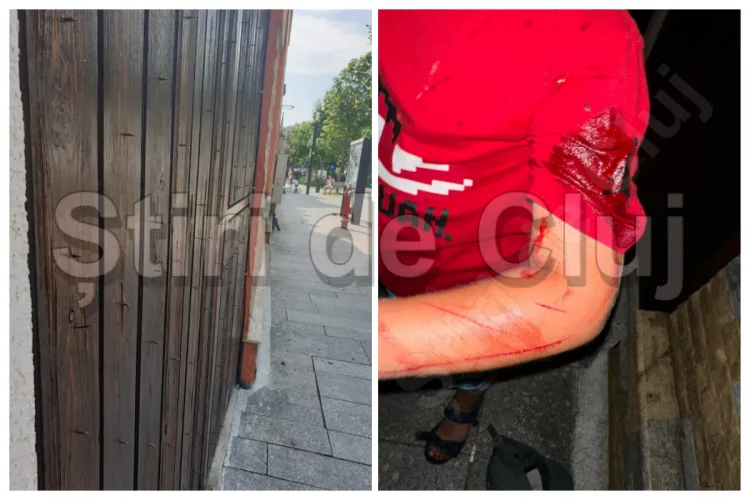 Anchetă în Cluj-Napoca după ce un băiețel de 7 ani a fost grav rănit: A căzut cu trotineta într-un gard plin de cuie ascuțite, puse intenționat FOTO