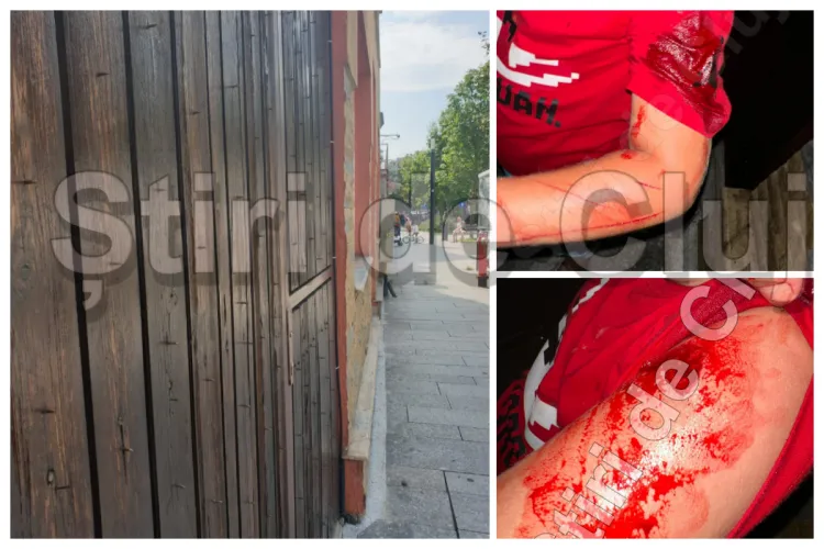 Incident șocant pe strada Smart din Cluj: Un băiețel de 7 ani a fost grav rănit, după ce a căzut cu trotineta într-un gard plin de cuie, puse intenționat