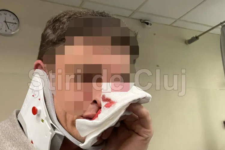 EXCLUSIV. Bătaie cruntă în centrul Clujului, în fața clubului After Eight: Clujean de 40 de ani lăsat lat la pământ cu fracturi multiple. Va fi operat FOTO